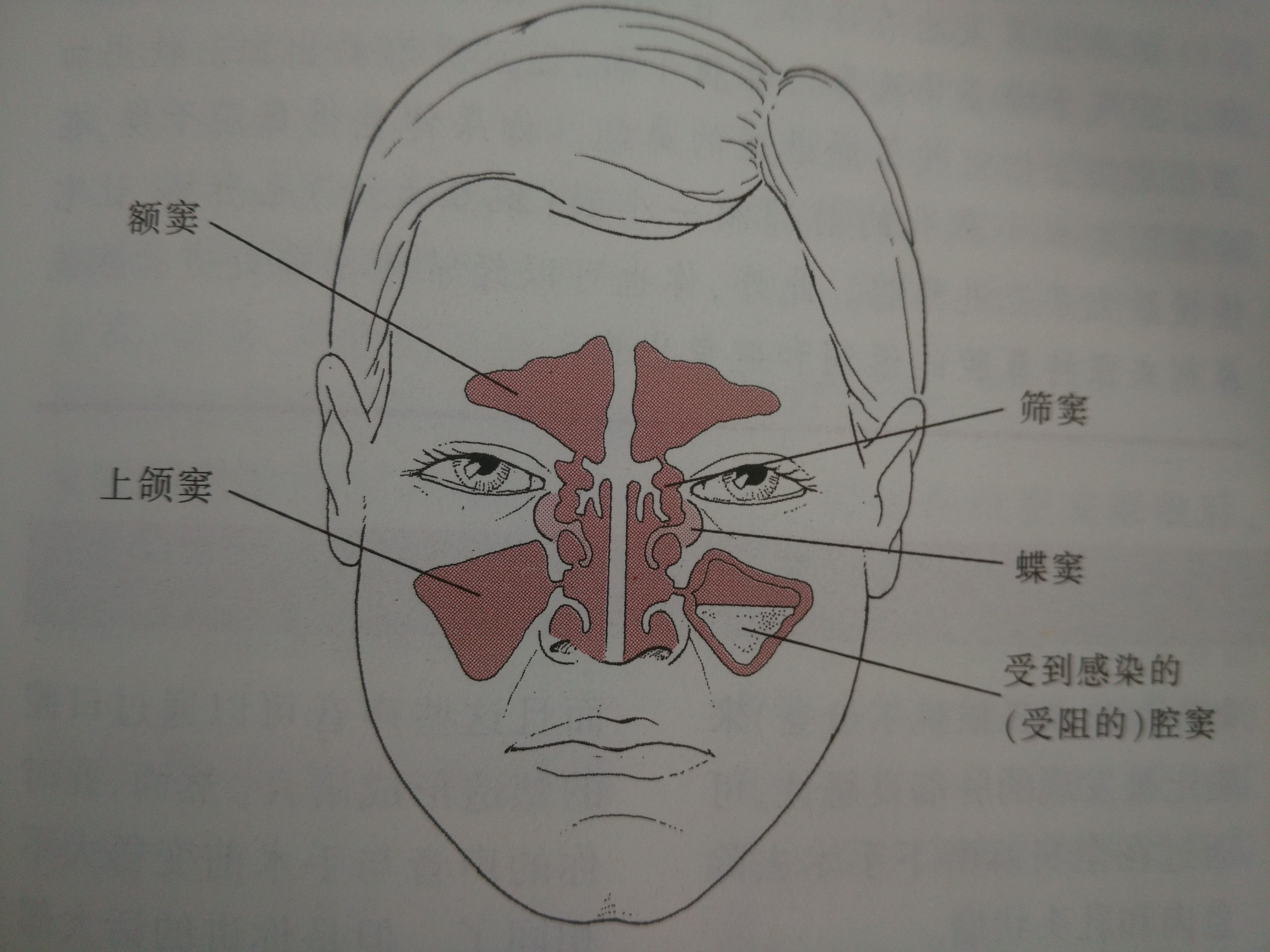 与其他鼻窦相比,筛窦和蝶窦在头骨中的位置更深.