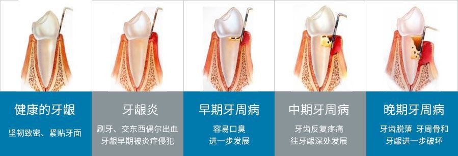 牙龈红肿出血是因为上火吗