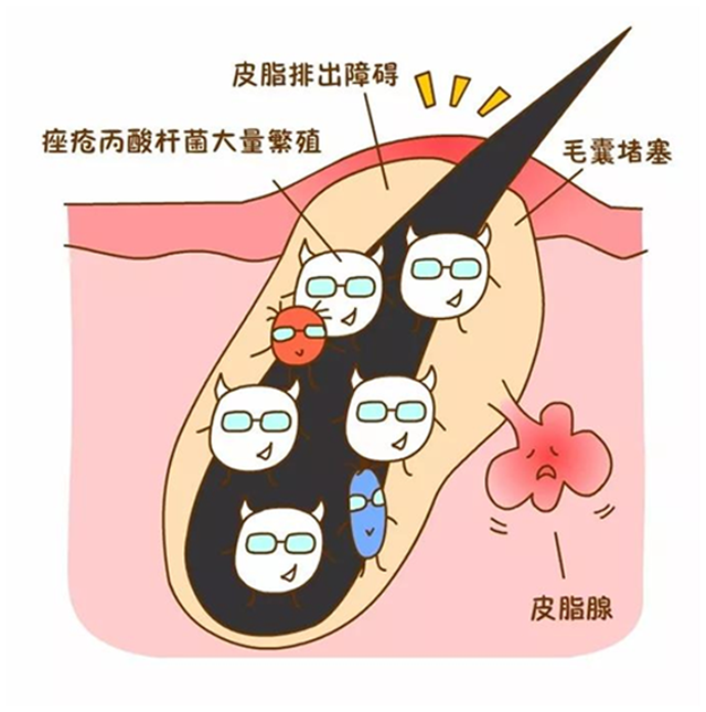 痘痘,黑头,闭口.这个夏日我想拥有正常肌肤-彭少文副主任医师-