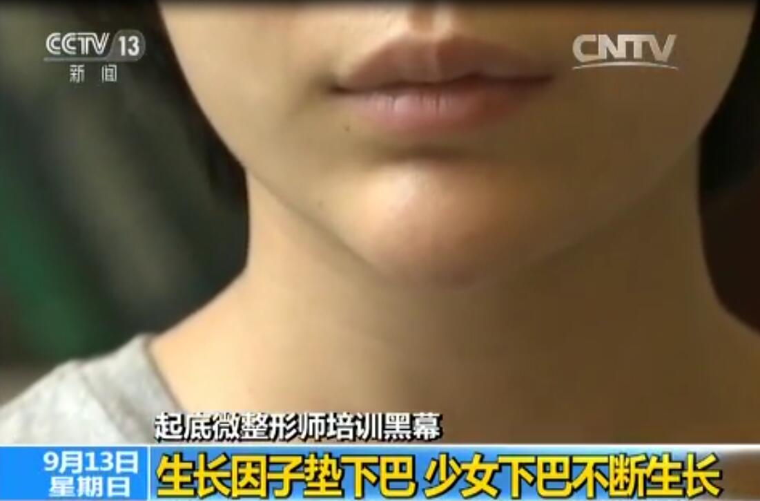 组织疯长,面部变形,生长因子注射后的惨痛代价