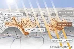 太阳斑(也称为老年斑)等色素沉着过度太阳过敏(uvb射线也会引起过敏