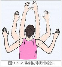 乳腺癌手术后多久,怎样锻炼上肢?