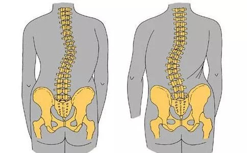 如头晕,头痛,脖子,背,肩,腰疼痛等,不正常的脊椎结构也会造成骨关节的