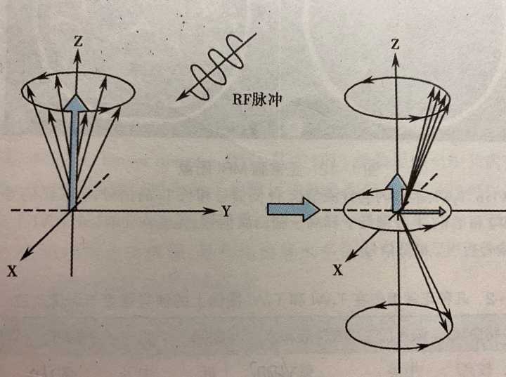 做核磁共振时医生让家属留下自己却出去是因为辐射太大了吗