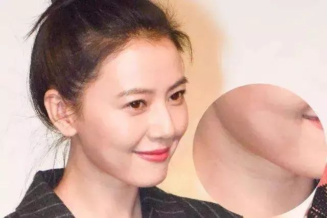 问题哦959595↑女神不能低头,因为颈纹会笑脸再美脖子苍老