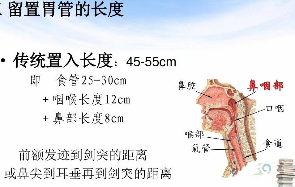 插胃管难受吗?什么时候可以拔除胃管?