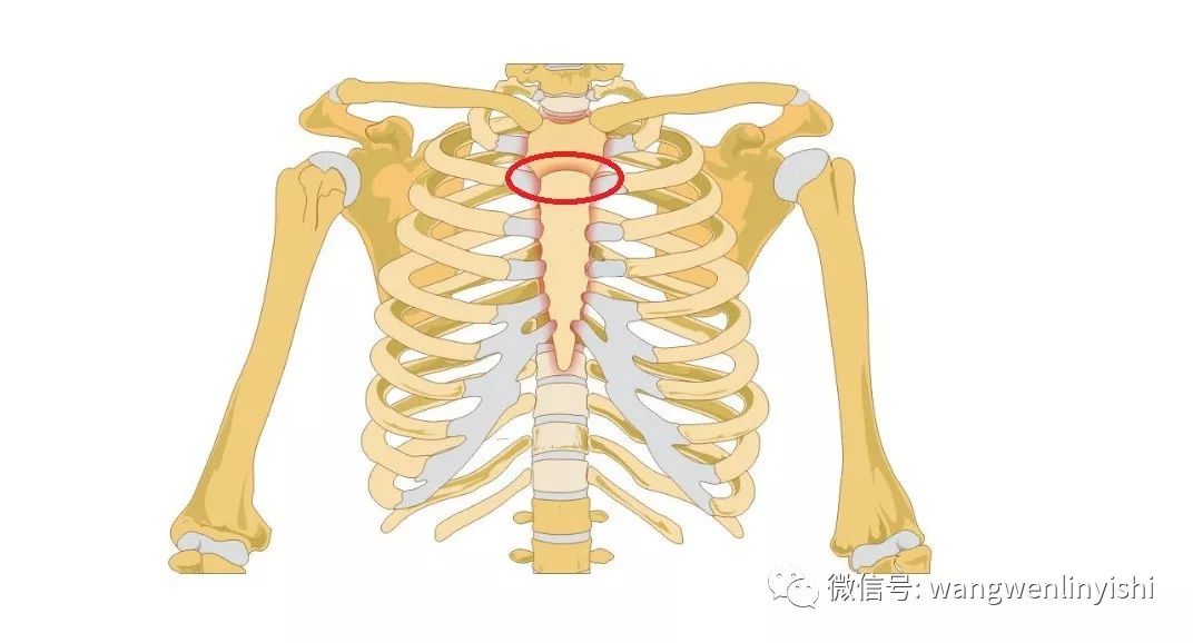 像很多此类美女一样,其主要的问题依然是胸骨角,该部位比较突出,令