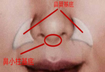 另外还有鼻孔基底,一般我们把它包含在鼻小柱基底部分,总之就是下面