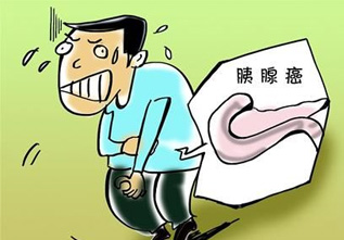 如何区分胰腺炎与胰腺癌的早期症状