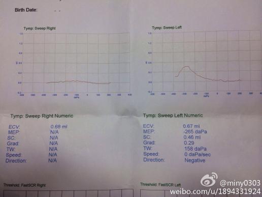 33个月鼻窦炎引起中耳炎,声导抗报告也表示不好 怎么医治?