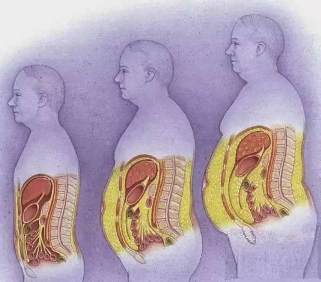 内脏脂肪超标严重如何短期内减掉内脏脂肪并提高基础代谢率