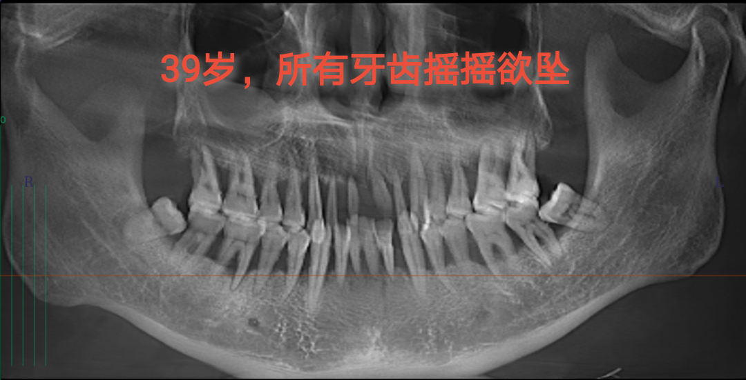 老掉牙