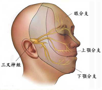 青春期出现于面部,好发于单侧三叉神经(主要是第1,2分支)分布区皮肤