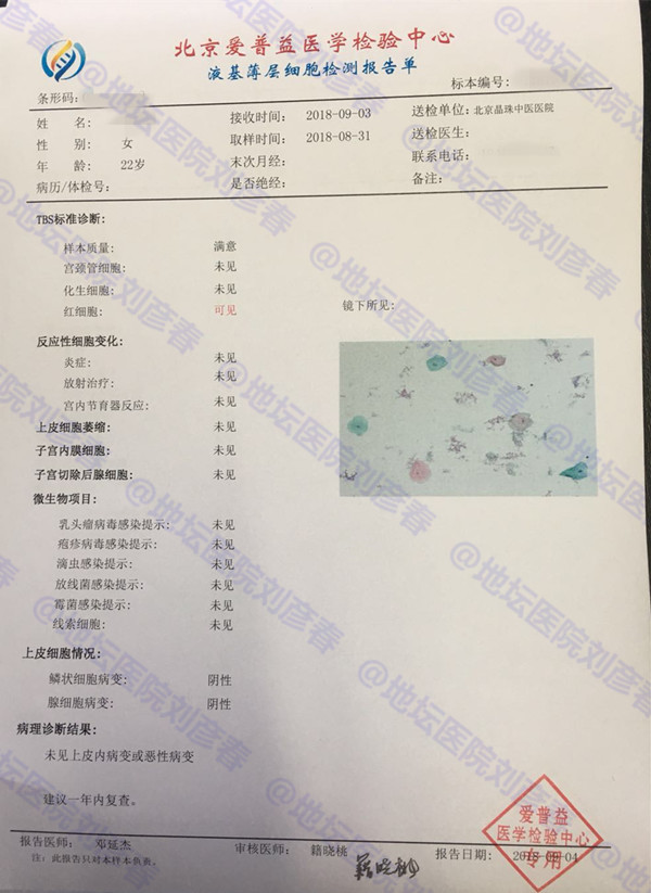 宫颈癌筛查中的tct报告提示炎症是怎么回事?是否需要治疗