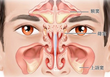 儿童患了鼻窦炎怎么办?