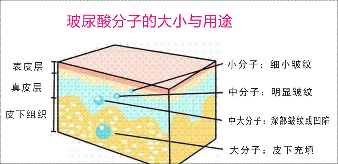 据整形医生肖添有个人经验分析,玻尿酸分子大小与维持时间如下,供大家