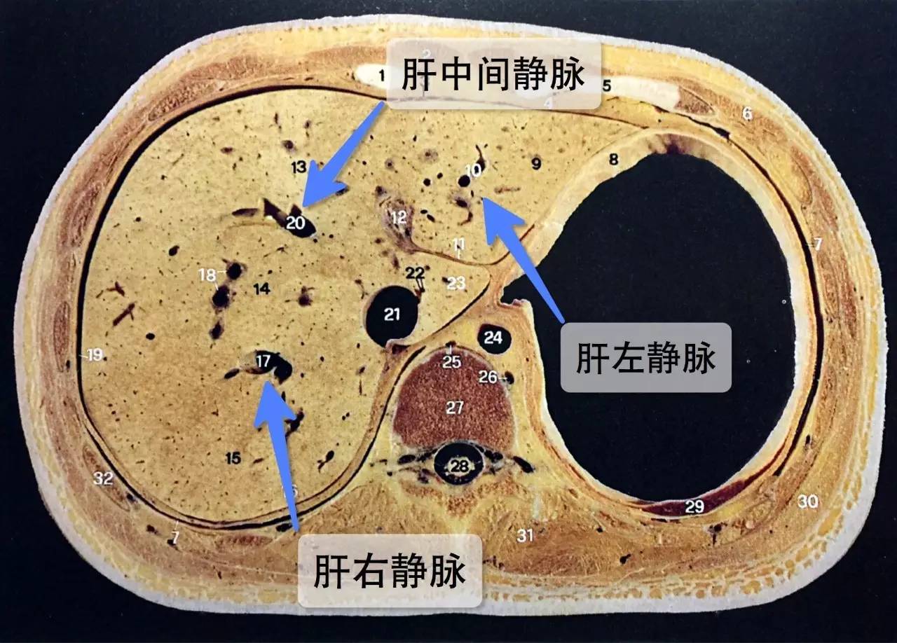 下腔静脉周围的肝静脉系统结语让我们总结一下:今天,我们在学习"经胃