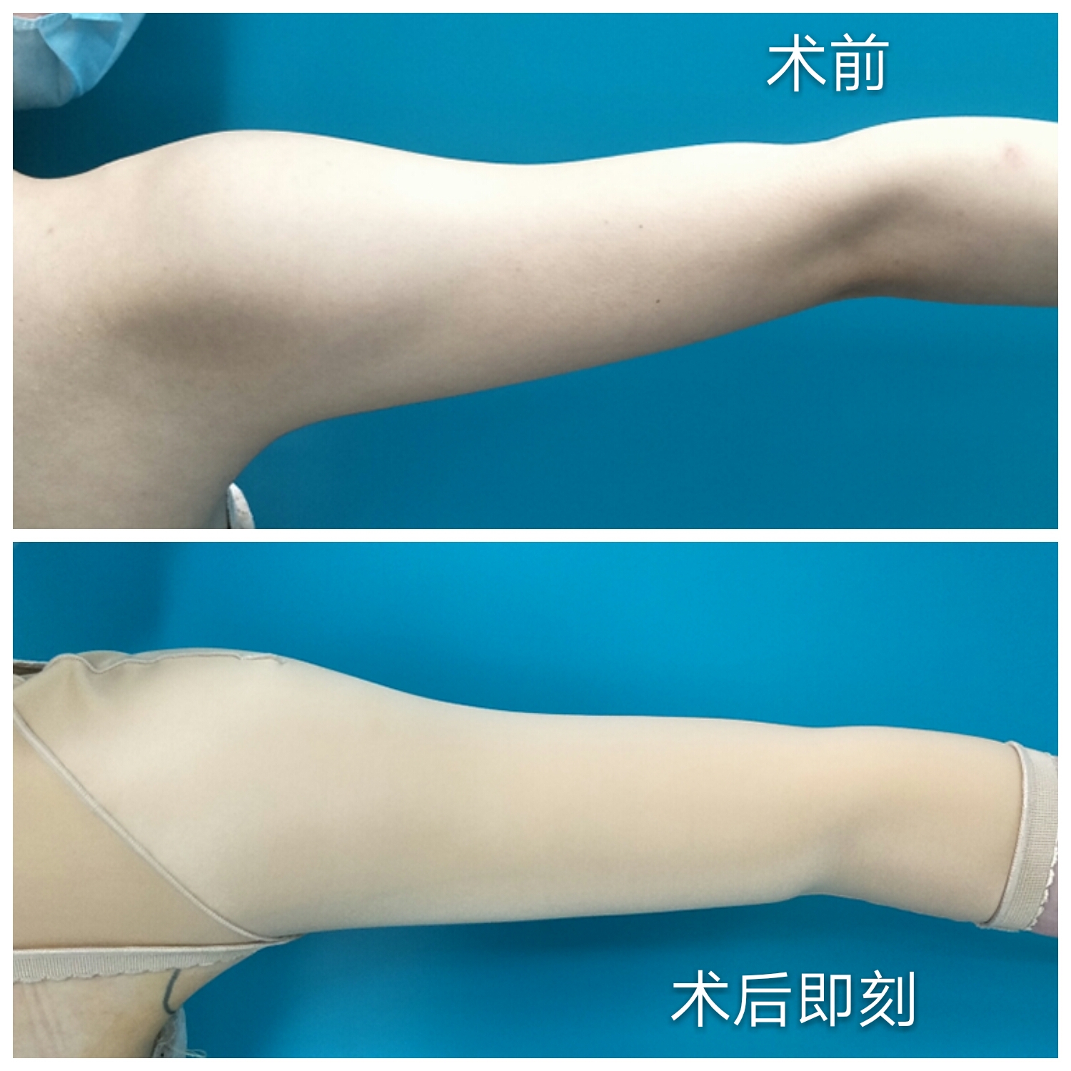 明明是个小仙女却因为手臂粗壮立马变成女汉子