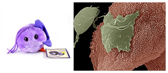 滴虫性阴道炎是否真有虫
