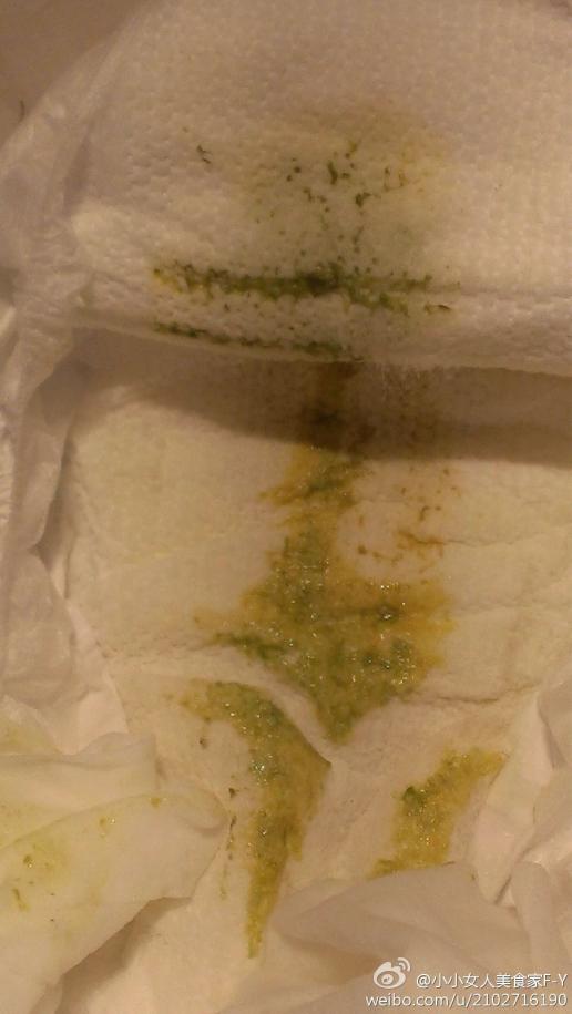 4个月大的宝宝拉的便便很稀,是绿色的,一天大便4次左右,是拉肚子了么
