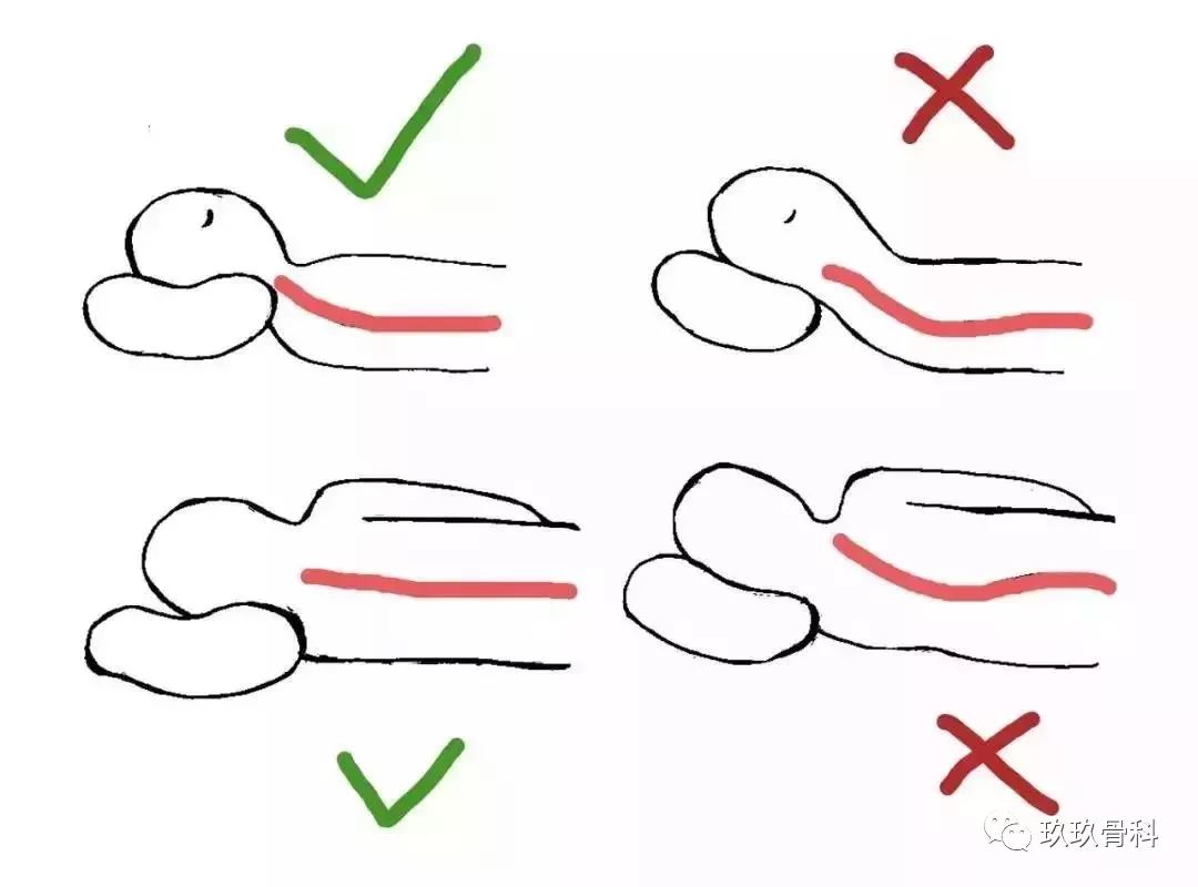 正确的睡姿是 躺在床上时,头和脖子的角度应与立正姿势时相差不多.