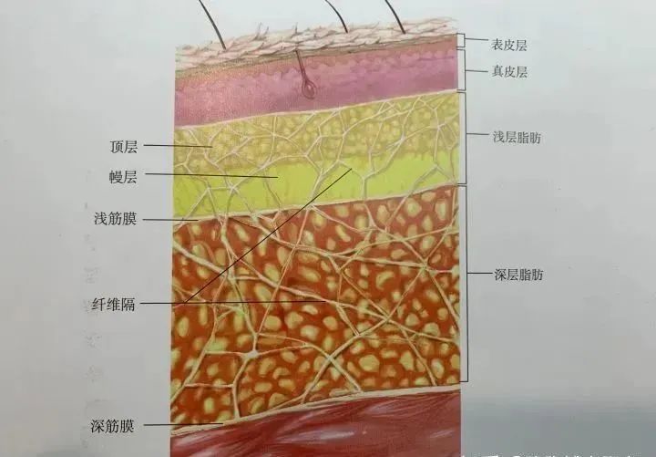 主要分成 表皮层-真皮层-浅层脂肪-浅筋膜-深层脂肪-深筋膜.