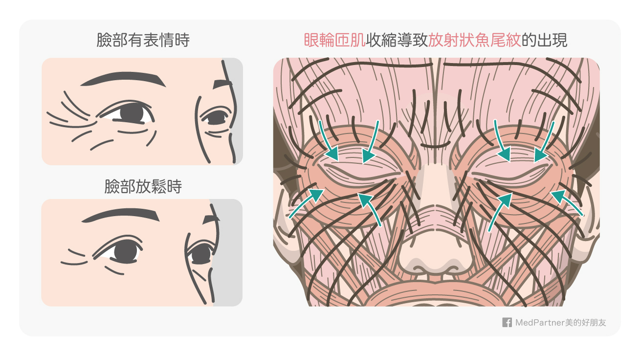 有鱼尾纹的那刻起,就开始衰老了吗?