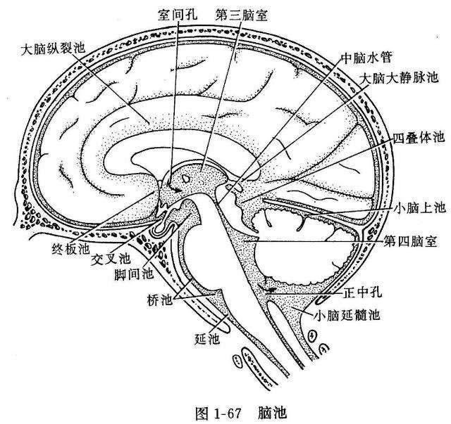 囊壁多为蛛网膜,神经胶质及软脑膜,囊内有脑脊液样囊液.