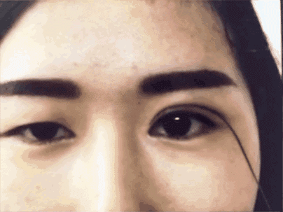 还在犹豫做不做双眼皮五大理由让你下定决心