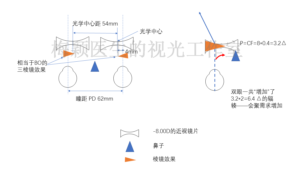 00d的近视镜,患者的瞳距是62mm,但装配时双眼镜片的光学中心距是54mm