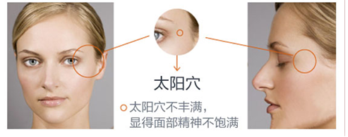 太阳穴凹陷不仅显老还影响运气?