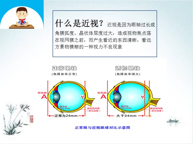 原理很简单,近视眼镜只是一种视力矫正工具,并不是治疗方法.