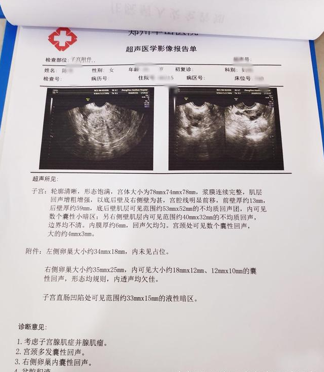 芳华岁月,18岁遇上子宫腺肌症,患病整整14年