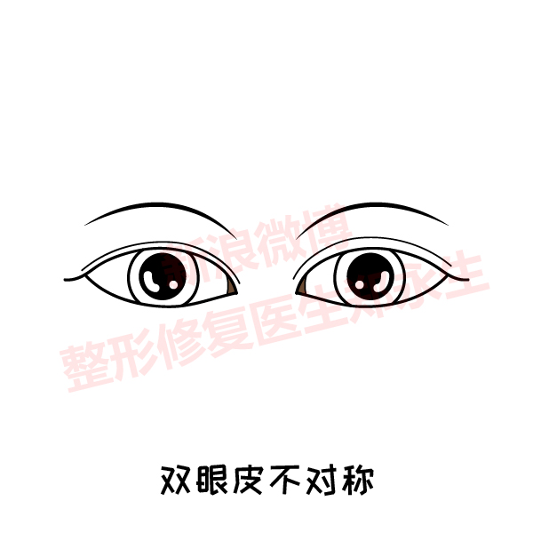 ˫Ƥʧ