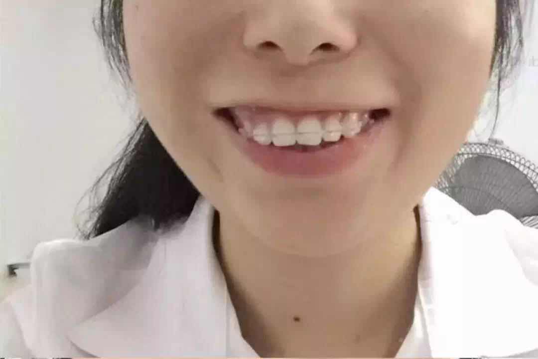 小姐姐龅牙,牙齿特别歪不比不知道,一比吓一跳先看看小姐姐