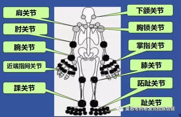 1,类风湿关节炎:小关节,手关节受累为主,大关节也可波及.