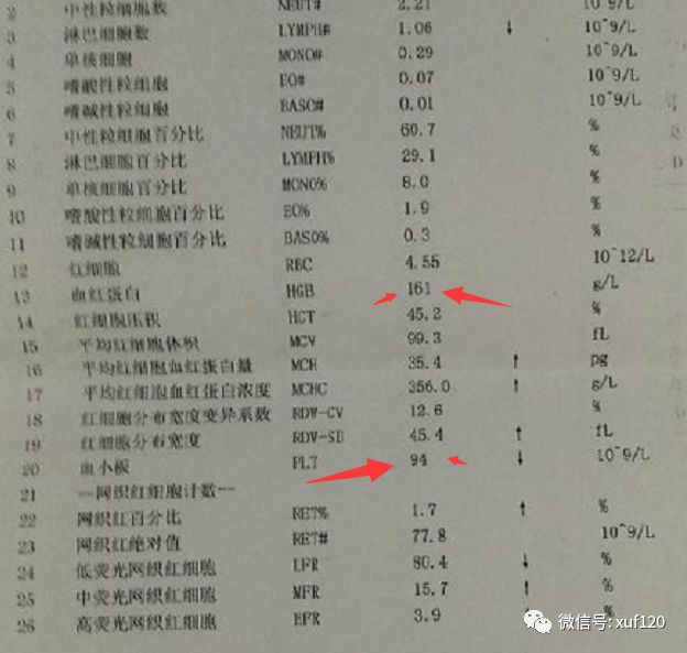 【再生障碍性贫血病友分享】不放弃,我做到了!