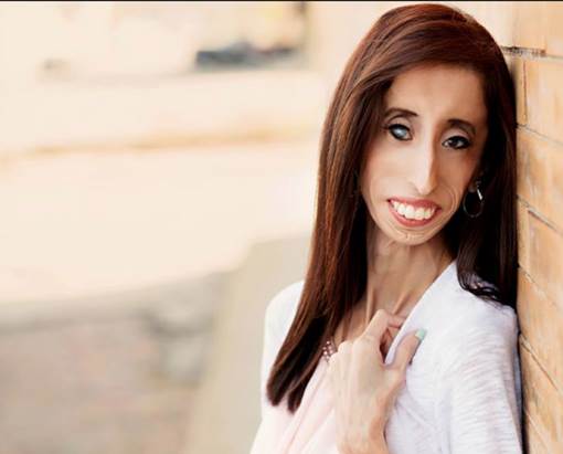 活着的勇气!世界上最丑女人