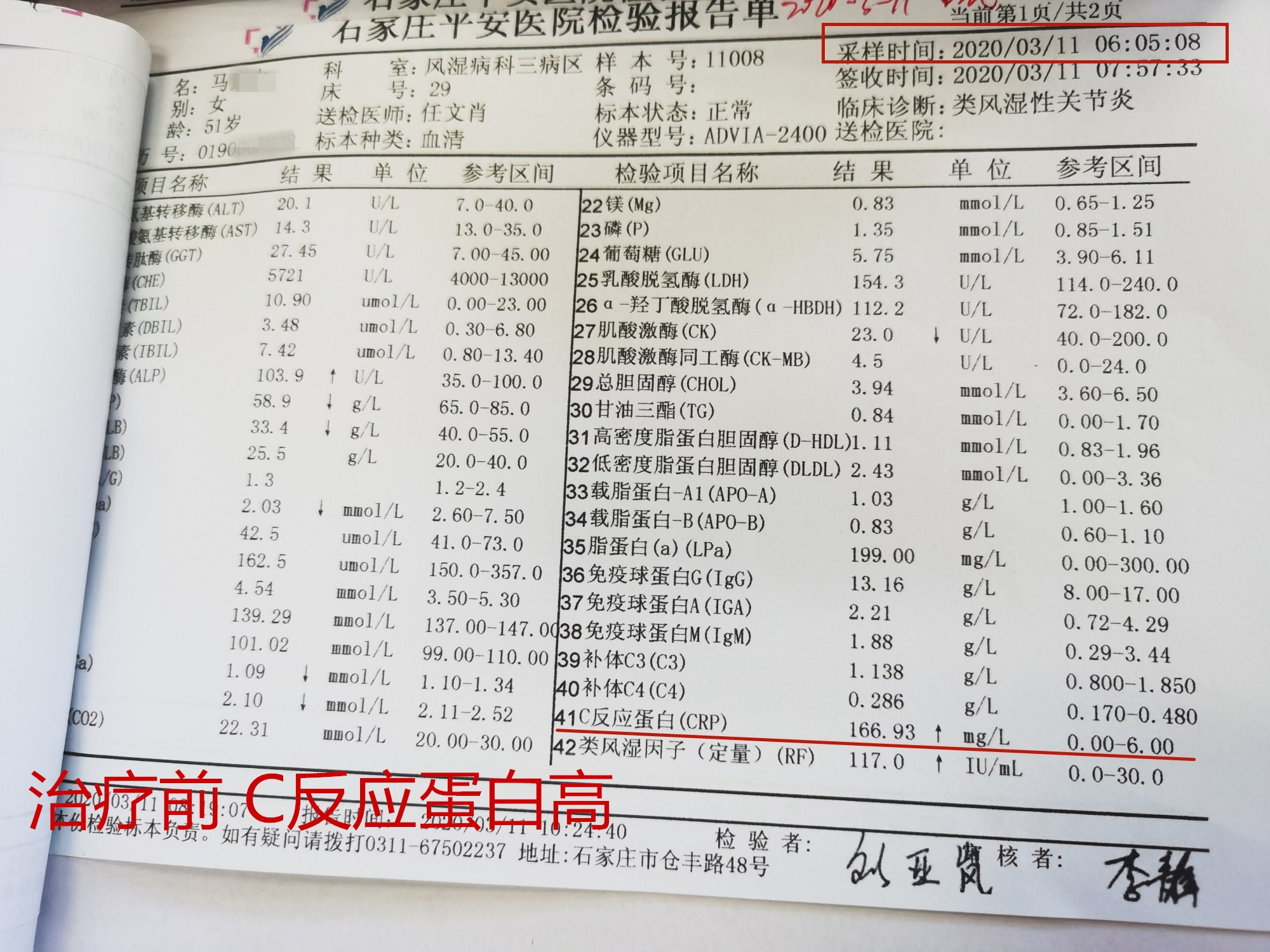 考虑患者c反应蛋白高,血沉高,病情处于活动期,采用免疫吸附治疗,需