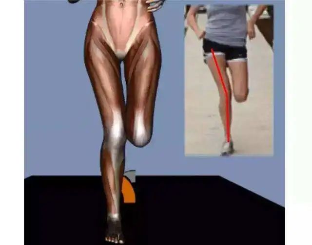 你为什么跑步膝盖疼?