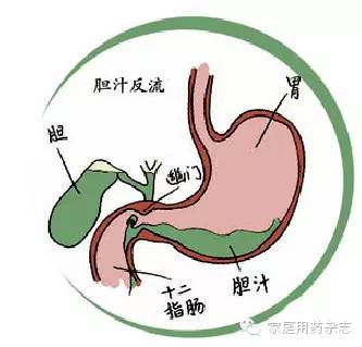 功能,引起h 弥散增加,而导致的胃黏膜慢性病变,多是由于幽门括约肌