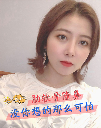 肋软骨隆鼻,没你想的那么可怕!