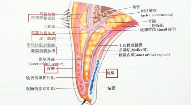 ▼先了解一下眼部解剖学构造把双眼皮术后的风险做出罗列,把一些三无