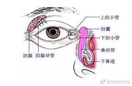 有一种肿泡眼叫做"泪腺脱垂"