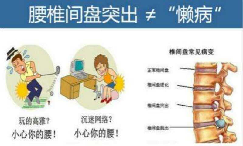 腰椎间盘突出是什么症状?