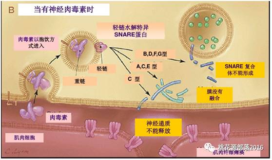 从基础到临床—3种a型肉毒杆菌毒素产品的比较