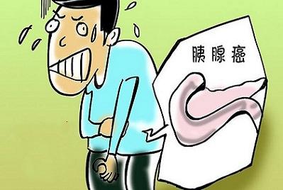 怀疑胰腺癌该怎么办?