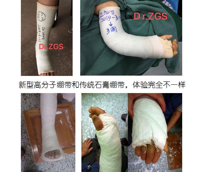 石膏外固定的历史变迁-李旭-爱问医生