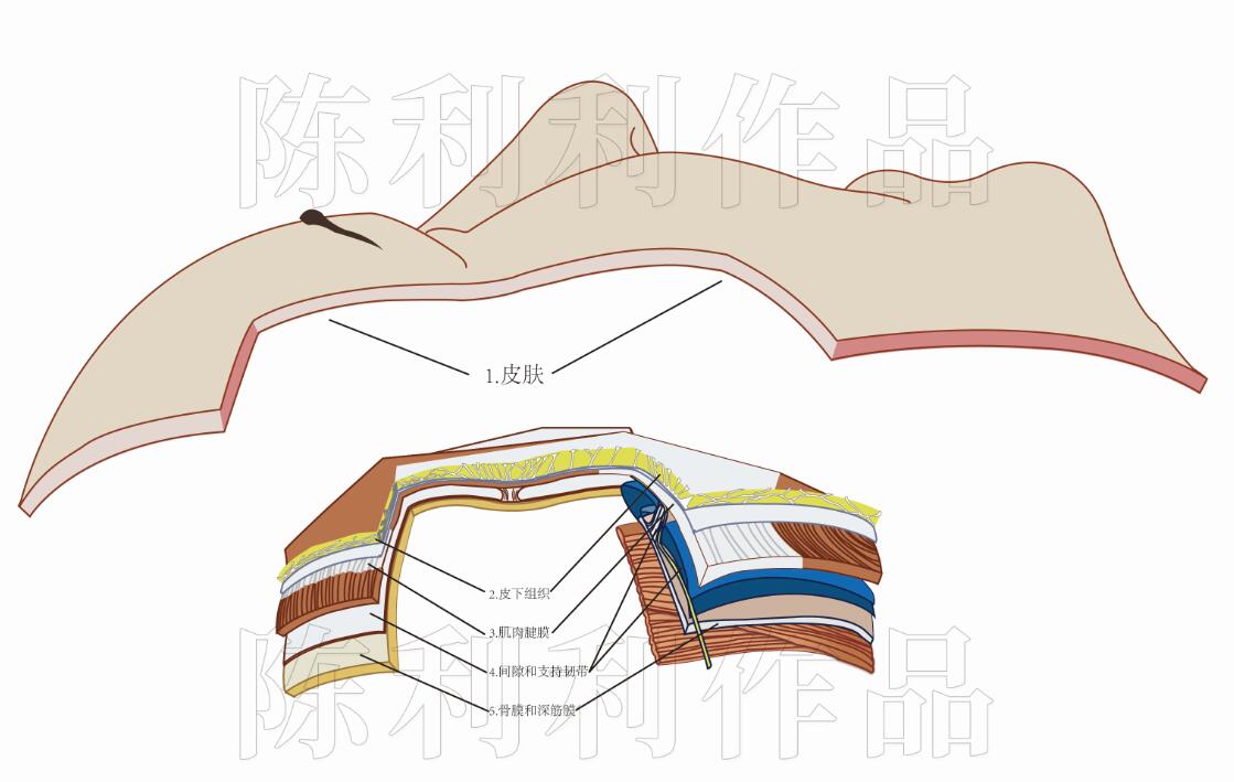 (三)面部埋线精细化之面部解剖层次—间隙支持韧带,骨膜深筋膜-陈利利