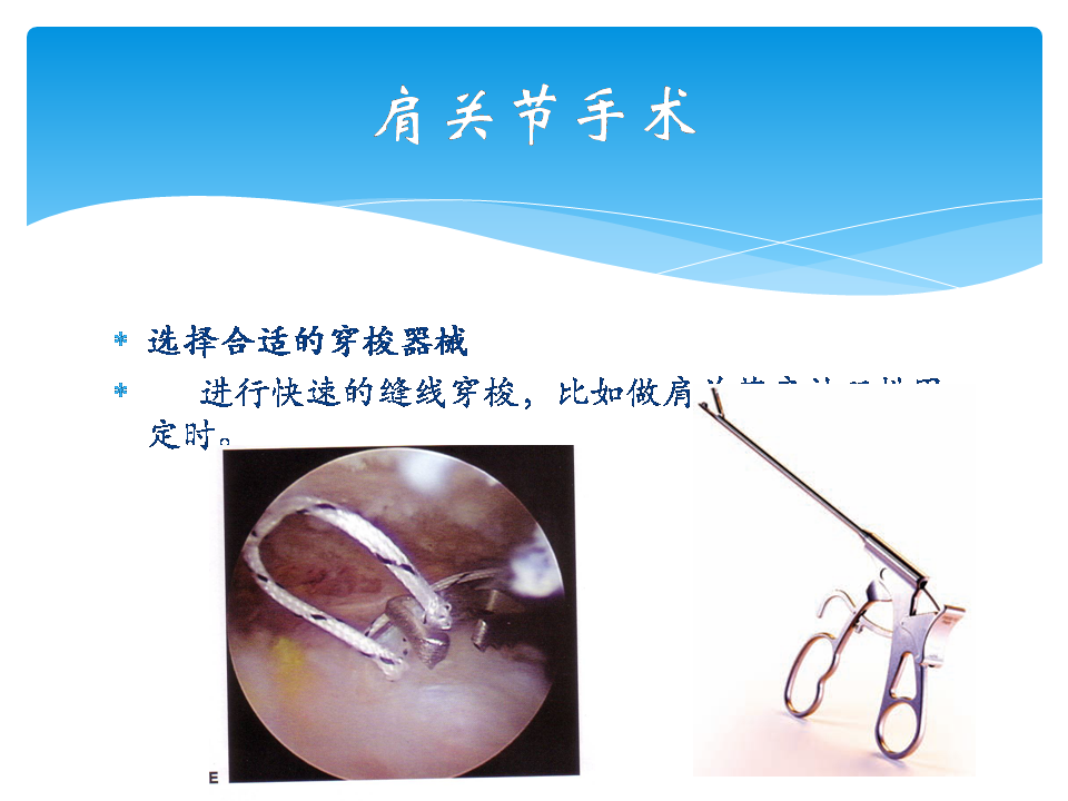 学习肩袖修补术